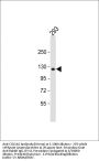 COL1A2 Antibody (N-term)