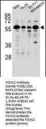 FOXC2 Antibody (Center P198)