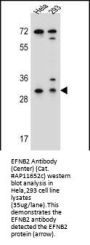 EFNB2 Antibody (Center)