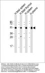 IGHG1 Antibody (Center)