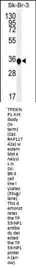 TP53INP1 Antibody (N-term)