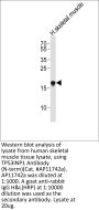 TP53INP1 Antibody (N-term)