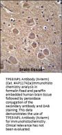 TP53INP1 Antibody (N-term)