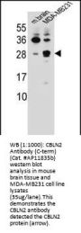 CBLN2 Antibody  (C-term)