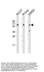 TGFBR2 Antibody (N-term)