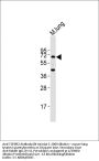TGFBR2 Antibody (N-term)