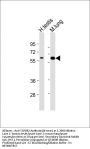 TGFBR2 Antibody (N-term)