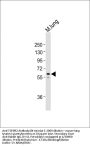 TGFBR2 Antibody (N-term)