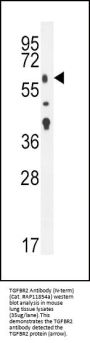 TGFBR2 Antibody (N-term)