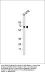 TGFBR2 Antibody (N-term)