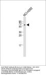 TRIM7  Antibody (N-term)
