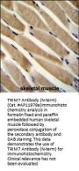 TRIM7  Antibody (N-term)