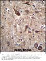 PTN Antibody (C-term)
