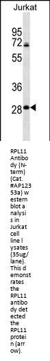 RPL11 Antibody (N-term)