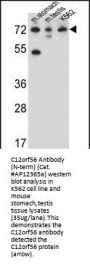 C12orf56 Antibody (N-term)
