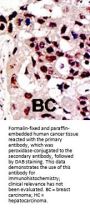 PIAS3 Antibody (C-term)