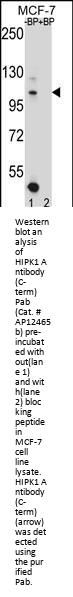 HIPK1 Antibody (C-term)