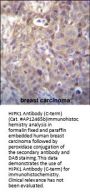 HIPK1 Antibody (C-term)