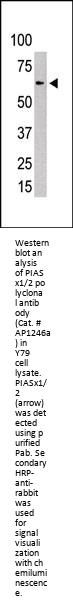 PIAS2 (PIASx1/2) Antibody (N-term)