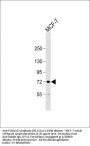 PIAS2 (PIASx1/2) Antibody (N-term)
