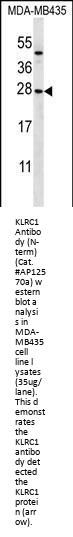KLRC1 Antibody (N-term)