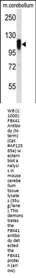 FBX41 Antibody (N-term)