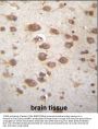 STAP2 Antibody (Center)