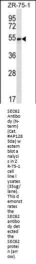 SEC62 Antibody (N-term)