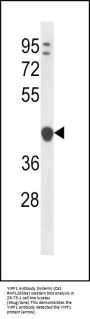 YIPF1 Antibody (N-term)