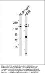 EGF Antibody (Center)