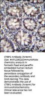 CTBP2 Antibody (N-term)