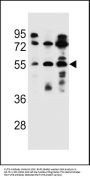 FUT6 Antibody (N-term)