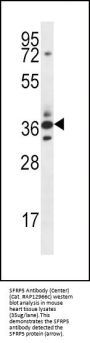 SFRP5 Antibody (Center)
