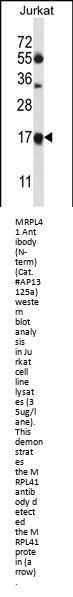 MRPL41 Antibody (N-term)