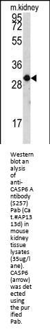 CASP6 Antibody (S257)