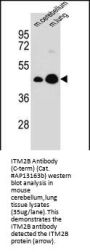 ITM2B Antibody (C-term)