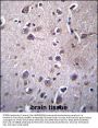 ITM2B Antibody (C-term)