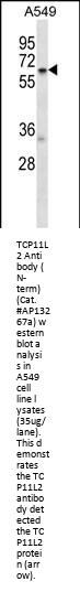 TCP11L2 Antibody (N-term)
