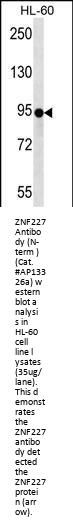 ZNF227 Antibody (N-term )