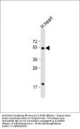 HtrA3 Antibody (N-term)
