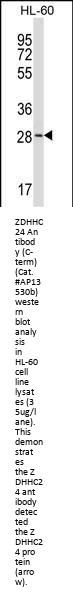 ZDHHC24 Antibody (C-term)