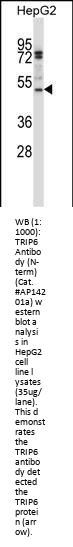 TRIP6 Antibody (N-term)