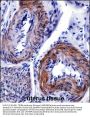 TRIP6 Antibody (N-term)