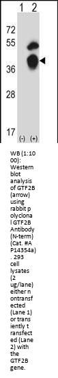 GTF2B Antibody (N-term)