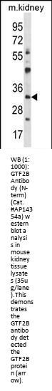 GTF2B Antibody (N-term)