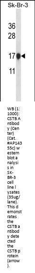 CSTB Antibody (Center)