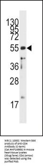 CD4 Antibody (C-term)