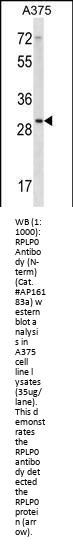 RPLP0 Antibody (N-term)