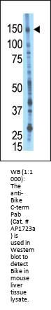 BIKE Antibody (Center)