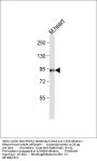 PROX1 Antibody (Center)